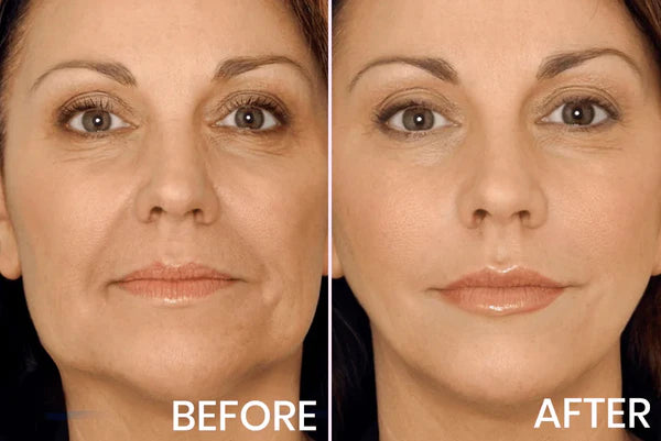 Anti - Rugas Firmador Multi cream Para A Pele 100ML