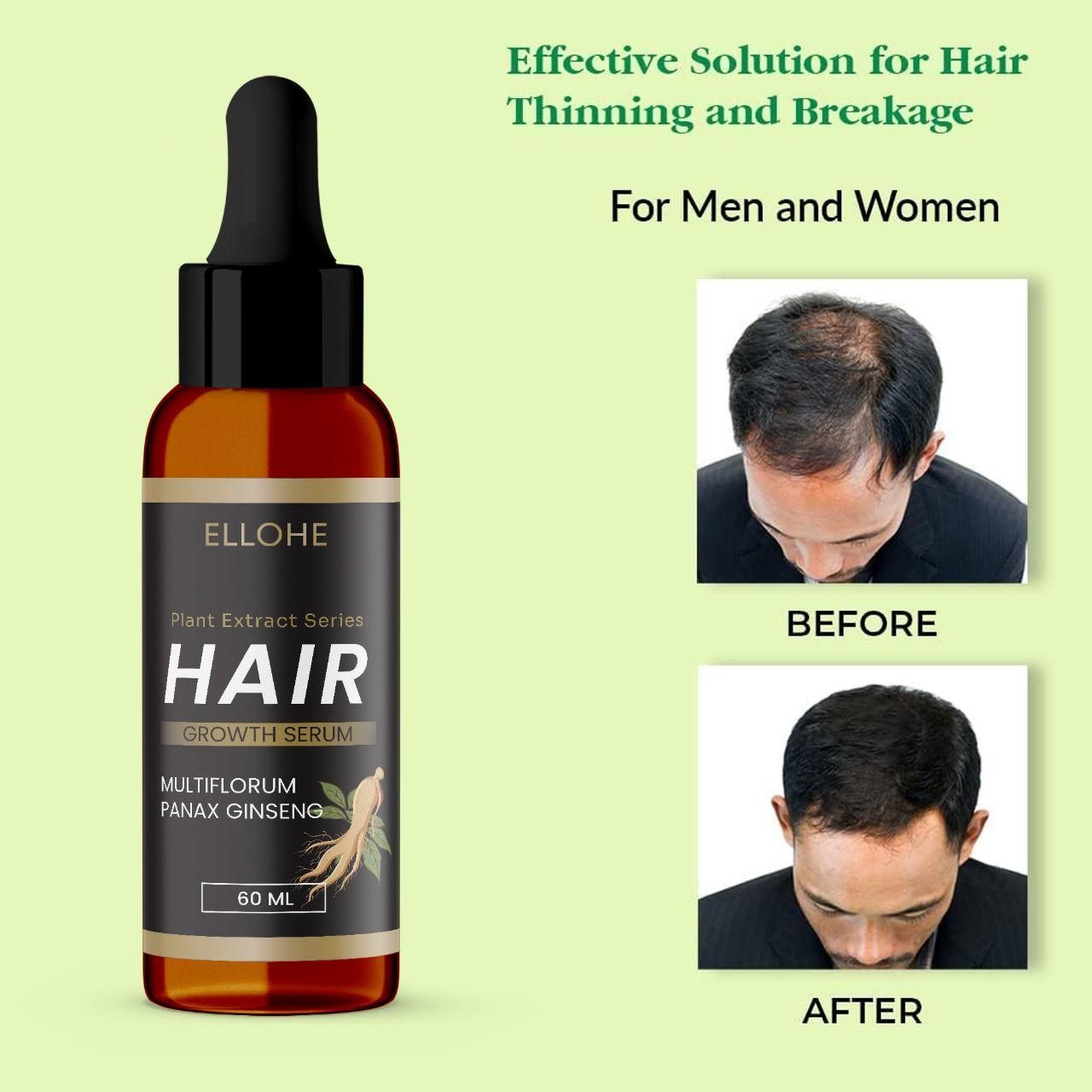 ELLOHE Plant Extract Series Hair Growth Serum 60ml Pack of 1